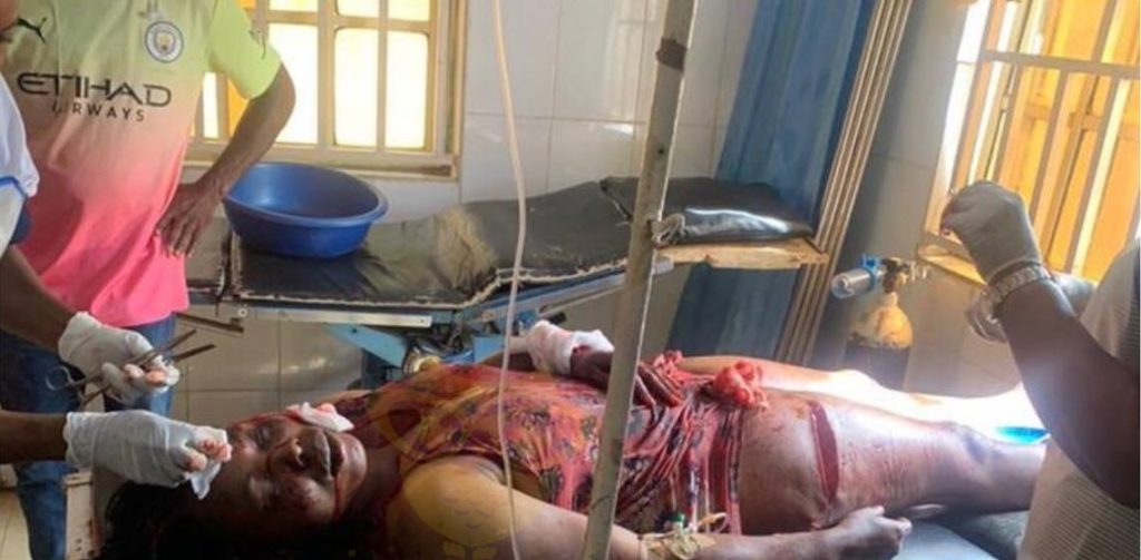 Man brutalizes girlfriend with a machete for breaking up with him (Graphic content)