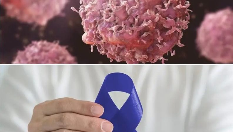 Doctor calls for early cancer checks, warns against delayed treatment