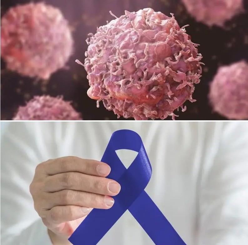 Doctor calls for early cancer checks, warns against delayed treatment